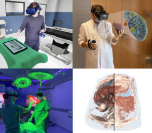 Versatile Immersive Virtual and Augmented Tangible OR - Using VR, AR and Tangibles to Support Surgical Practice 